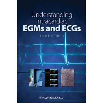 Understanding Intracardiac EGMs and ECGs  Kusumoto Fred  Wiley - Blackwell  9781405184106