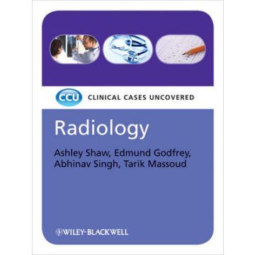 Radiology: Clinical Cases Uncovered  Shaw Ashley; Godfrey Edmund; Singh Abhinav; Massoud Tarik  Wiley - Blackwell  9781405184748