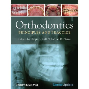Orthodontics: Principles and Practice  Gill Daljit; Naini Farhad B.  Wiley - Blackwell  9781405187473