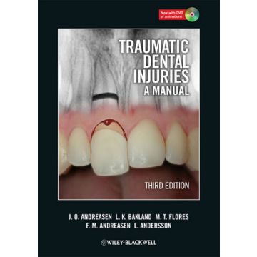 Traumatic Dental Injuries: A Manual, 3ed.  Andreasen Jens O.; Bakland Leif K.; Flores Maria Teresa; Andreasen Frances M.; Andersson Lars  Wiley - Blackwell  9781405190619