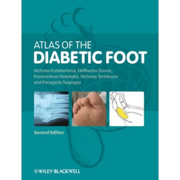 Atlas of the Diabetic Foot, 2ed.  Katsilambros Nicholas; Dounis Eleftherios; Makrilakis Konstantinos; Tentolouris Nikolaos; Tsapogas Panagiotis  Wiley - Blackwell  9781405191791