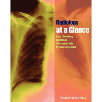 Radiology at a Glance  Chowdhury Rajat; Wilson Iain; Rofe Christopher; Lloyd-Jones Graham  Wiley - Blackwell  9781405192200