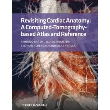 Revisiting Cardiac Anatomy: A Computed-Tomography-Based Atlas and Reference  Saremi Farhood  Wiley - Blackwell  9781405194693
