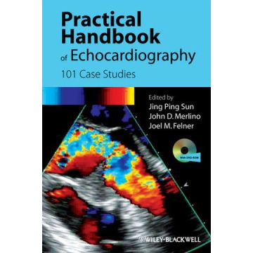 Practical Handbook of Echocardiography: 101 Case Studies  Sun Jing Ping; Felner Joel; Merlino John  Wiley - Blackwell  9781405195560