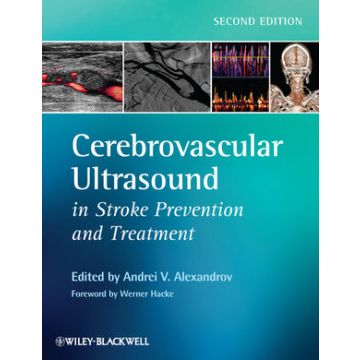 Cerebrovascular Ultrasound in Stroke Prevention and Treatment, 2ed.  Alexandrov Andrei V.; Hacke Werner  Wiley - Blackwell  9781405195768