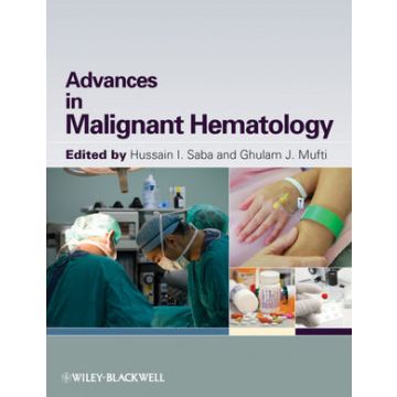 Advances in Malignant Hematology  Saba Hussain I.; Mufti Ghulam  Wiley - Blackwell  9781405196260