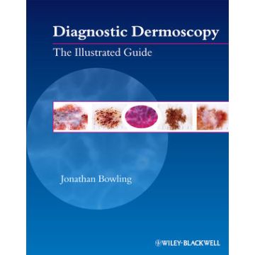 Diagnostic Dermoscopy: The Illustrated Guide  Bowling Jonathan  Wiley - Blackwell  9781405198554