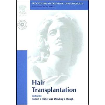 Procedures in Cosmetic Dermatology Series: Hair Transplantation - Text with DVD, 1Edition