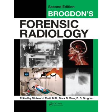 Brogdon's Forensic Radiology 2/ed.