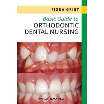 Basic Guide to Orthodontic Dental Nursing  Grist Fiona  Wiley - Blackwell  9781444333183
