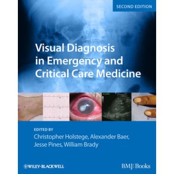 Visual Diagnosis in Emergency and Critical Care Medicine, 2ed.  Holstege Christopher P.; Baer Alexander B.; Pines Jesse M.; Brady William J.  Wiley - Blackwell  9781444333473