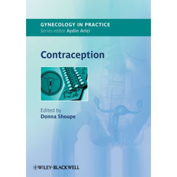 Contraception  Shoupe Donna  Wiley - Blackwell  9781444333510