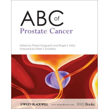 ABC of Prostate Cancer  Dasgupta Prokar; Kirby Roger S.  Wiley - Blackwell  9781444334371