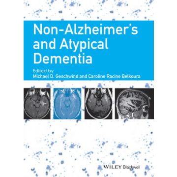 Non-Alzheimer's and Atypical Dementia  Geschwind Michael D.; Racine Belkoura Caroline  Wiley - Blackwell  9781444336245