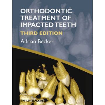 Orthodontic Treatment of Impacted Teeth, 3ed.  Becker Adrian  Wiley - Blackwell  9781444336757