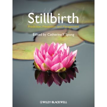 Stillbirth: Prediction, Prevention and Management  Spong Catherine Y.  Wiley - Blackwell  9781444337068