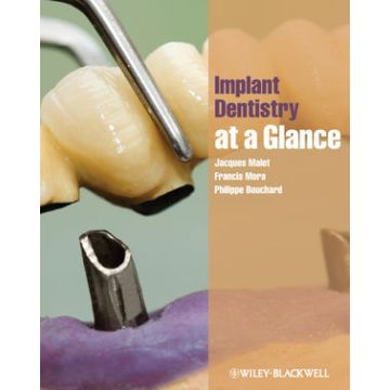 Implant Dentistry at a Glance  Malet Jacques; Mora Francis; Bouchard Philippe  Wiley - Blackwell  9781444337440