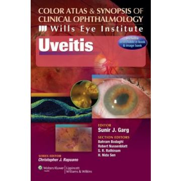Color Atlas and Synopsis of Clinical Ophthalmology - Wills Eye Institute - Uveitis  Garg Sunir J.  LIPPINCOTT Williams and Wilkins  9781451101461