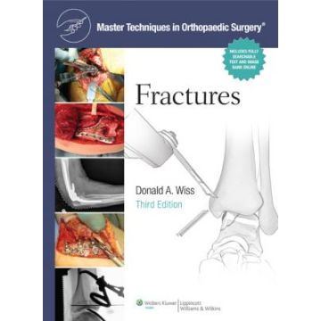 Master Techniques in Orthopaedic Surgery: Fractures, 3ed.  Wiss Donald  LIPPINCOTT Williams and Wilkins  9781451108149