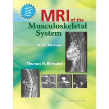 MRI of the Musculoskeletal System, 6ed.  Berquist Thomas H.  LIPPINCOTT Williams and Wilkins  9781451109184