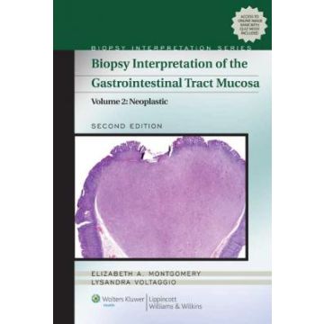 Biopsy Interpretation of the Gastrointestinal Tract Mucosa, 2ed. Vol. 2: Neoplastic  Montgomery Elizabeth A.; Voltaggio Lysandra  LIPPINCOTT Williams and Wilkins  9781451109597