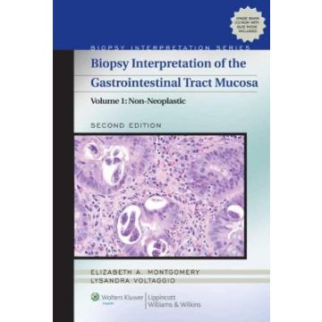Biopsy Interpretation of the Gastrointestinal Tract Mucosa. Vol. 1: Non-neoplastic, 2ed.  Montgomery Elizabeth A.; Voltaggio Lysandra  LIPPINCOTT Williams and Wilkins  9781451109603