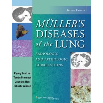 Muller's Diseases of the Lung, 2ed.  Lee Kyung Soo; Franquet Tomás; Han Joungho; Johkoh Takeshi  LIPPINCOTT Williams and Wilkins  9781451111163