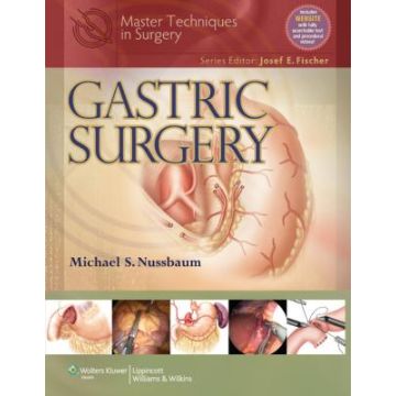 Master Techniques in Surgery: Gastric Surgery  Nussbaum Michael  LIPPINCOTT Williams and Wilkins  9781451112979