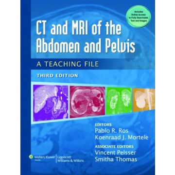 CT & MRI of the Abdomen and Pelvis, 3ed.  Ros Pablo R.; Mortele Koenraad J.  LIPPINCOTT Williams and Wilkins  9781451113525
