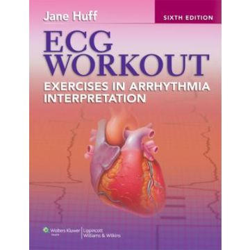 ECG Workout, 6ed.  Huff Jane  LIPPINCOTT Williams and Wilkins  9781451115536