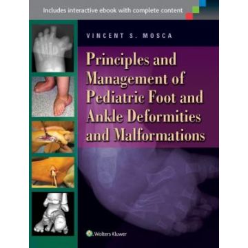 Principles and Management of Pediatric Foot and Ankle Deformities and Malformations  Mosca Vincent S.  LIPPINCOTT Williams and Wilkins  9781451130454