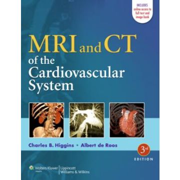MRI and CT of the Cardiovascular System, 3ed.  Higgins Charles B.; de Roos Albert  LIPPINCOTT Williams and Wilkins  9781451137316