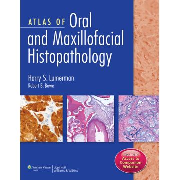 Atlas of Oral and Maxillofacial Histopathology  Lumerman Harry S.; Bowe Robert B.  LIPPINCOTT Williams and Wilkins  9781451143140