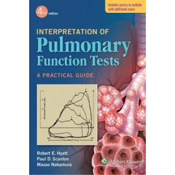Interpretation of Pulmonary Function Tests, 4ed. - Hyatt Robert E.; Scanlon Paul D.; Nakamura Masao - LIPPINCOTT Williams and Wilkins - 9781451143805