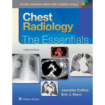 Chest Radiology, 3ed. The Essentials - Collins Janette; Stern Eric J. - LIPPINCOTT Williams and Wilkins - 9781451144482