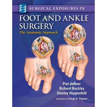 Surgical Exposures in Foot & Ankle Surgery  deBoer Piet; Buckley Richard; Hoppenfeld Stanley  LIPPINCOTT Williams and Wilkins  9781451144505