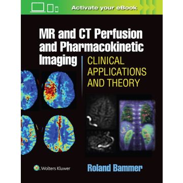 MR & CT Perfusion Imaging: Clinical Applications and Theoretical Principles   Bammer Roland  LIPPINCOTT Williams and Wilkins  9781451147155