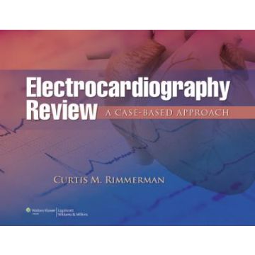 Electrocardiography Review  Rimmerman Curtis M.  LIPPINCOTT Williams and Wilkins  9781451149470