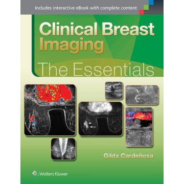 Clinical Breast Imaging. The Essentials - Cardenosa Gilda - LIPPINCOTT Williams and Wilkins - 9781451151770