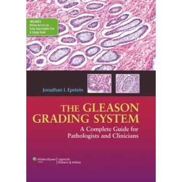 The Gleason Grading System: A Complete Guide for Pathologists and Clinicians  Epstein Jonathan I.  LIPPINCOTT Williams and Wilkins  9781451172829