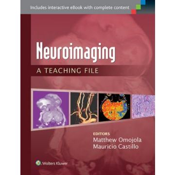 Neuroimaging: A Teaching File - Omojola Matthew; Castillo Mauricio - LIPPINCOTT Williams and Wilkins - 9781451173284