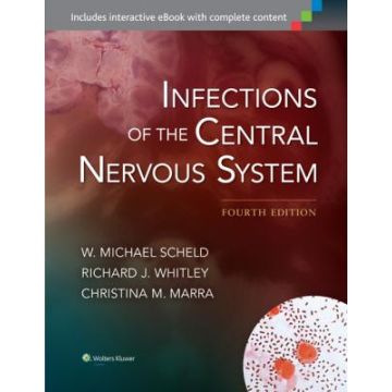 Infections of the Central Nervous System, 4ed. - Scheld W. Michael; Whitley Richard J.; Marra Christina M. - LIPPINCOTT Williams and Wilkins - 9781451173727