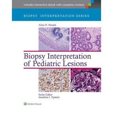 Biopsy Interpretation of Pediatric Lesions - Husain Aliya N. - LIPPINCOTT Williams and Wilkins - 9781451175332