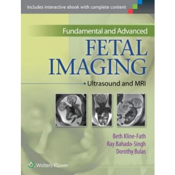 Fundamental and Advanced Fetal Imaging. ULTRASOUND AND MRI - Kline-Fath Beth; Bahado-Singh Ray; Bulas Dorothy - LIPPINCOTT Williams and Wilkins - 9781451175837