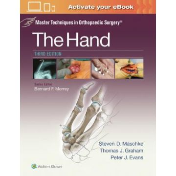 Master Techniques in Orthopaedic Surgery: The Hand, 3ed.  Graham Thomas J.; Maschke Steven; Evans Peter  LIPPINCOTT Williams and Wilkins  9781451182781