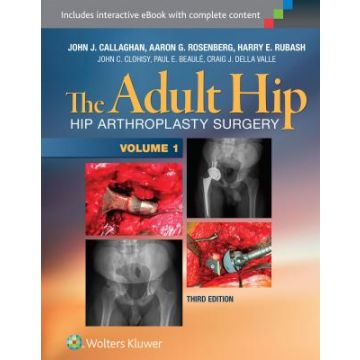The Adult Hip. Hip Arthroplasty Surgery, 3ed. Two volume set  Callaghan John J.  LIPPINCOTT Williams and Wilkins  9781451183696