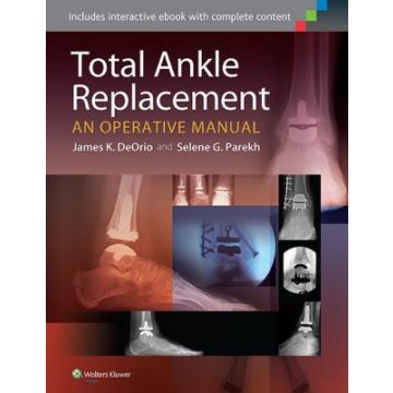 Total Ankle Replacement: An Operative Manual  DeOrio James K.; Parekh Selene G.  LIPPINCOTT Williams and Wilkins  9781451185225