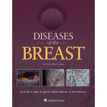 Diseases of the Breast 5ed. - Harris Jay R.; Lippman Marc E.; Morrow Monica; Osborne C. Kent - LIPPINCOTT Williams and Wilkins - 9781451186277