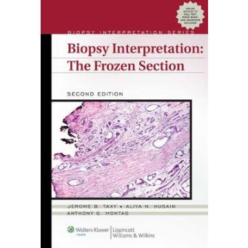 Biopsy Interpretation: The Frozen Section, 2ed.  Taxy Jerome B.  LIPPINCOTT Williams and Wilkins  9781451186796
