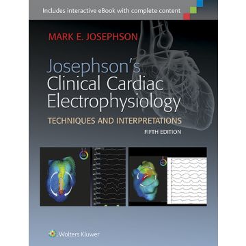 Josephson's Clinical Cardiac Electrophysiology, 5ed.  Josephson Mark E.  LIPPINCOTT Williams and Wilkins  9781451187410